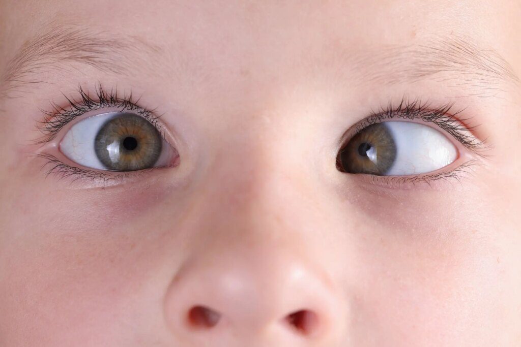 ATCC Laser eye surgery for children Guest post 2