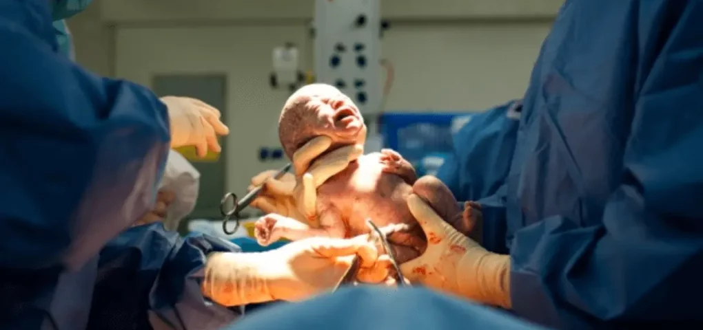 newly born infant
